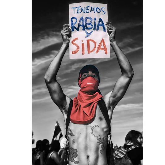 Tenemos Rabia y SIDA